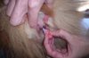 2009-03-22_231123_vaginal_polyp.jpg