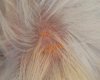 herbstgrasmilben-xl-450.jpg