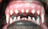 VDC_Misalignment_Overbite1.jpg