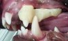 VDC_Misalignment_Overbite4.jpg