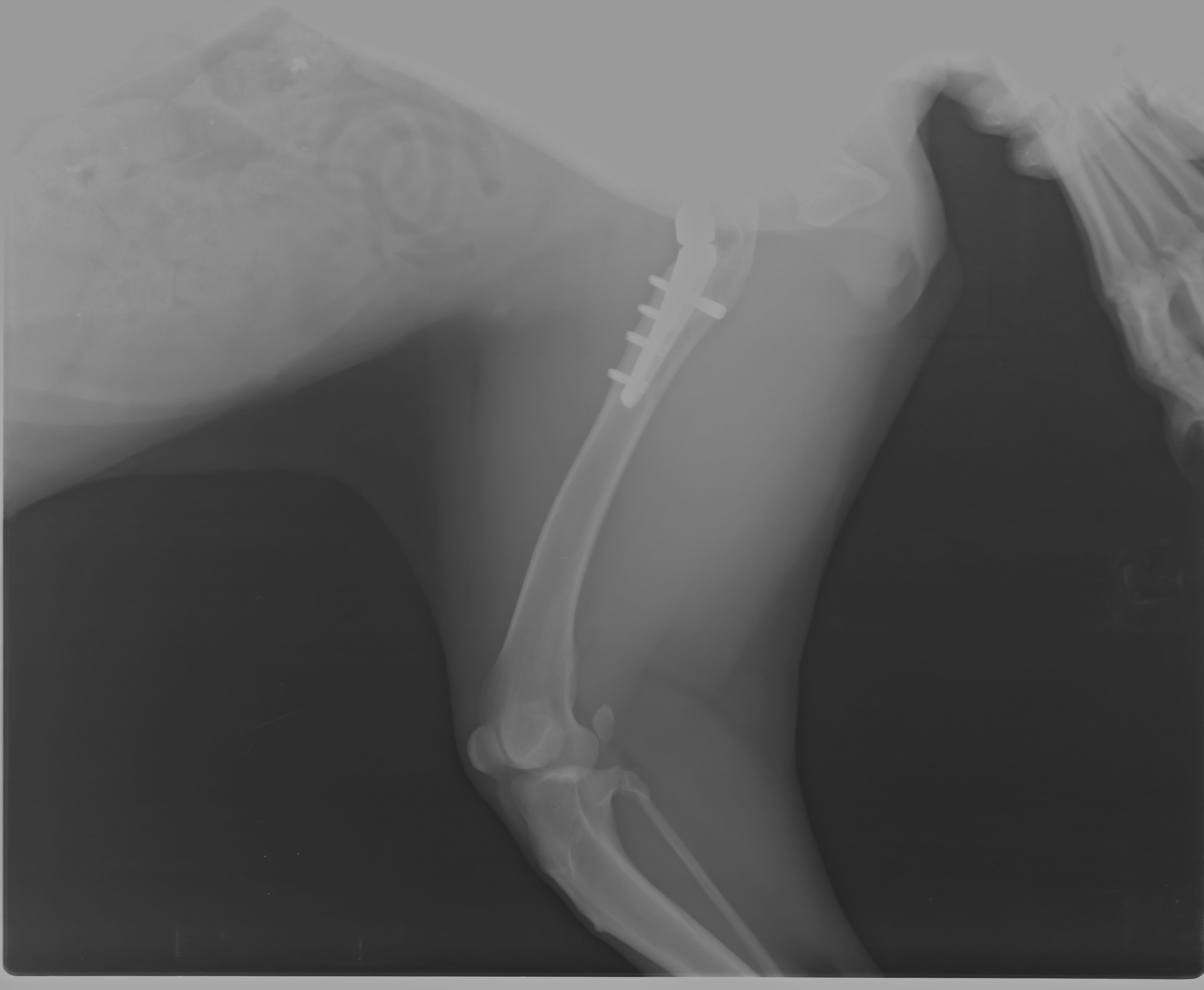 1st Surgery after 7 months (1)