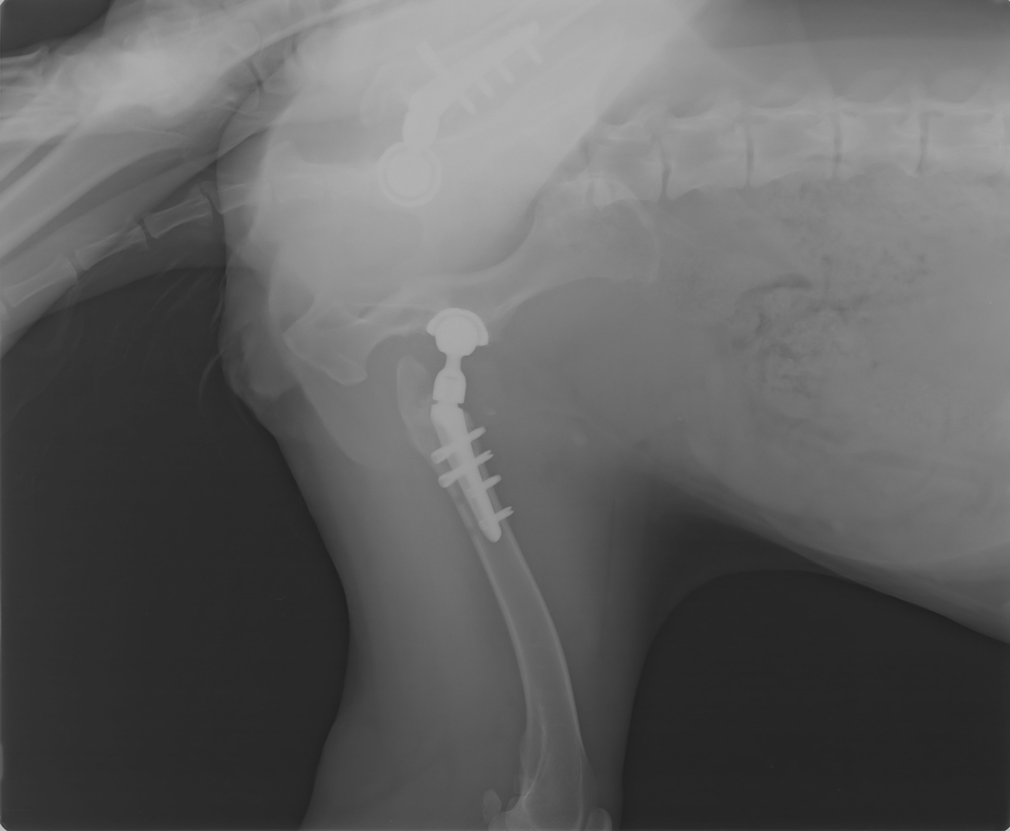 2nd Surgery after 6 days  (3)